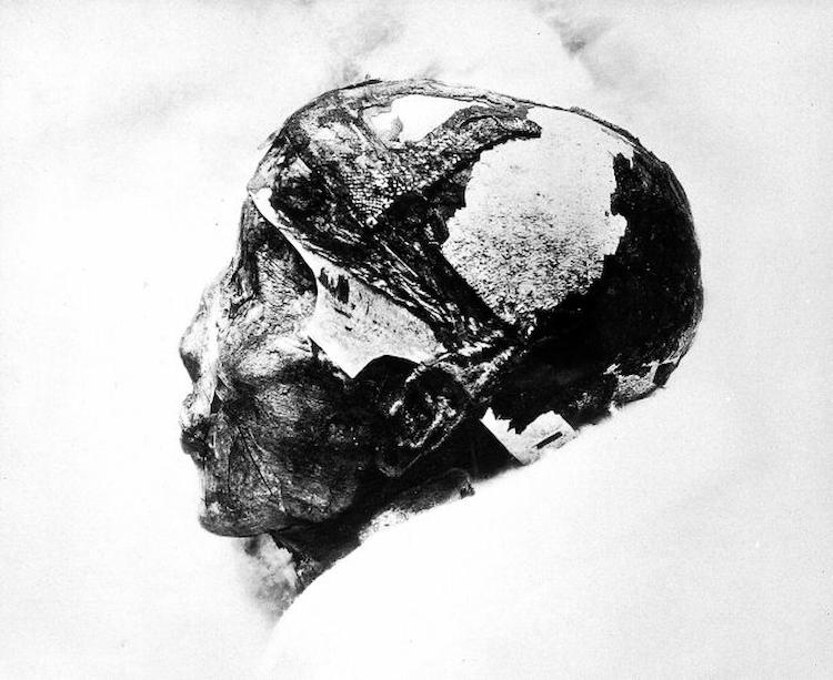Tutankhamuns mummified head
